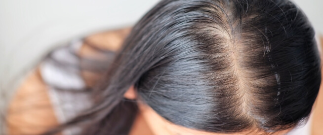 علاج خفة الشعر تقنية ريجينيرا أكتيفا