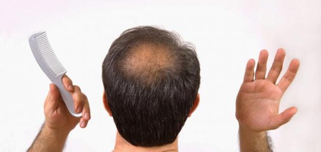 ماسكات لتساقط الشعر تقنية Regenera Activa أفضل علاج